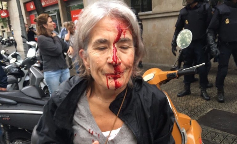 Χάος στην Καταλωνία - Ακραία αστυνομική βία και εκατοντάδες τραυματίες (Photos-videos)