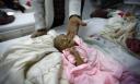 Αποκάλυψη-σοκ από τη Unicef: Στην Υεμένη 2,2 εκατ. παιδιά λιμοκτονούν