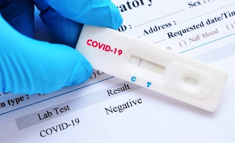 Test ανίχνευσης αντισωμάτων του ιού εγκρίθηκε στις ΗΠΑ