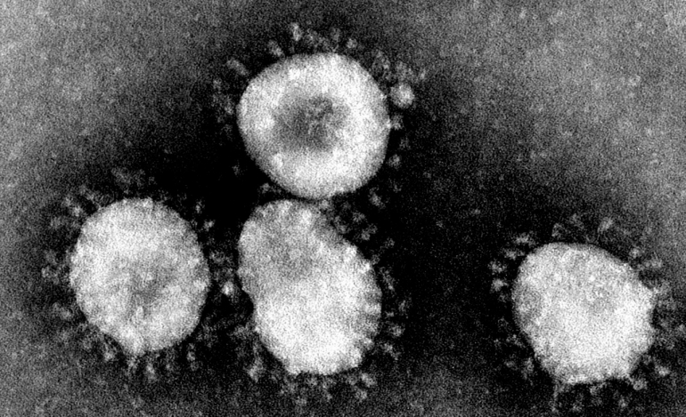 O ιός του SARS σε εικόνα ηλεκτρονικού μικροσκοπίου διέλευσης